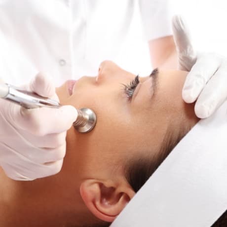 Huidverbetering diamondpeel