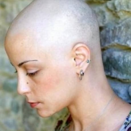 Schoonheidszorgen bij kankerpatienten