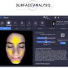Huidanalyse apparaat SmartSkin